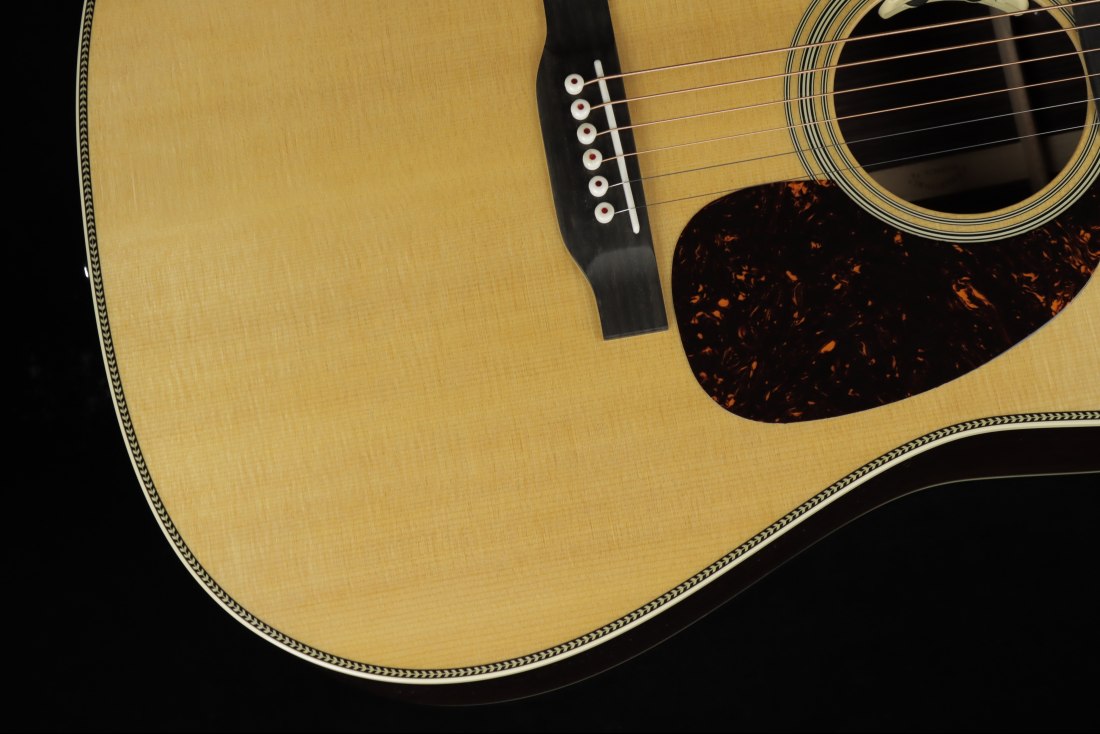 Martin HD-28E L.R Baggs Anthem