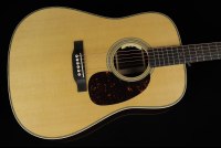 Martin HD-28E L.R Baggs Anthem